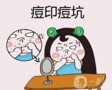 激光祛痘印要多久才能见效