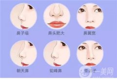 假体隆鼻好的材料是什么？