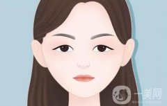 开外眼角后恢复需要多长时间
