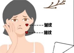 哪些部位适合大V线，有什么副作用