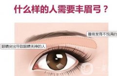 提眉术和切眉术有什么区别？