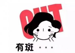 哪些人群适合激光祛斑？