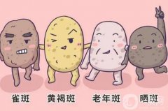 激光祛斑后有哪些禁忌症