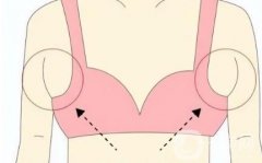 副乳和乳腺增生有什么区别？