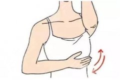 副乳切除后有哪些注意事项