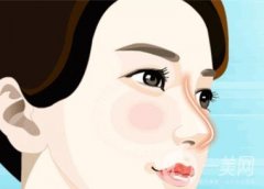 鼻整形手术矫正朝天鼻效果如何？