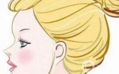 玻尿酸丰苹果肌有哪些副作用