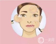 线雕和玻尿酸有什么区别？