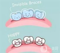 牙齿矫正的设备有哪些