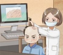 植发的风险有哪些