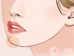 玻尿酸注射下巴后是否会变硬？
