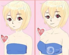 副乳切除术是否会影响乳房？