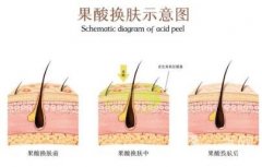 彩光嫩肤后化妆有哪些注意事项