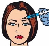 玻尿酸适用于哪些部位呢？