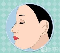 鼻综合感染的应对与预防措施