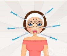 玻尿酸去除皱纹究竟需要多久才能见效