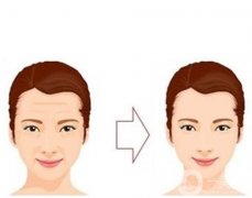 玻尿酸除皱的效果可以永久吗