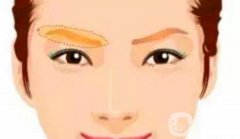 提眉手术的风险有哪些