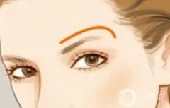 提眉手术的效果有哪些