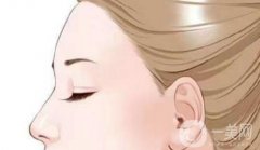 提眉手术与双眼皮手术需要间隔多久？