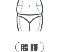 吸脂后是否会反弹？