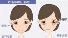 眼袋修复的方法有哪些？