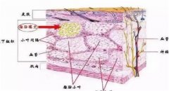 自体脂肪丰苹果肌的优点