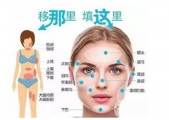 自体脂肪填充额头有什么缺点？