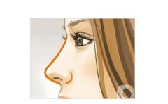 取出假体隆鼻后多久可以恢复