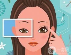 上睑下垂的成因与矫正费用