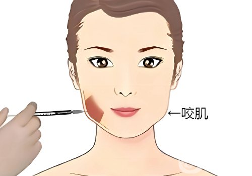 乔雅登雅致和极致区别在哪?信息对比一览