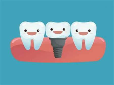 单颗种植牙价格一览：比较市场价，选择经济实惠的牙医诊所