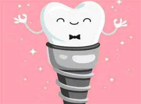 大牙种植牙一颗多少钱？详细解读种植牙价格及相关因素