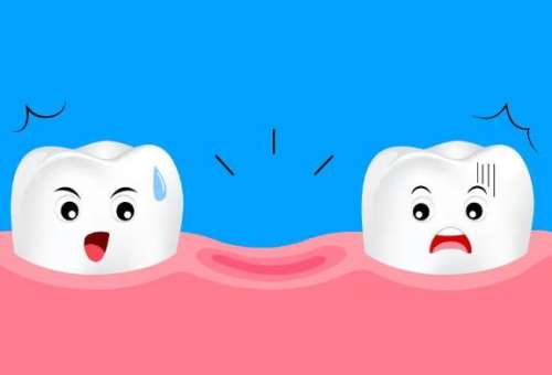 前面牙缝大怎么处理？有多种可行的方法！