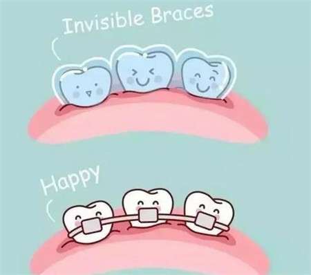 戴牙套会引起怎样程度的疼痛?了解疼痛级别以做好准备!