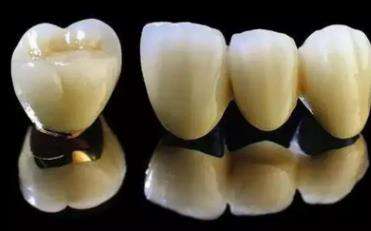 门牙6颗全瓷牙连冠还是单颗好？