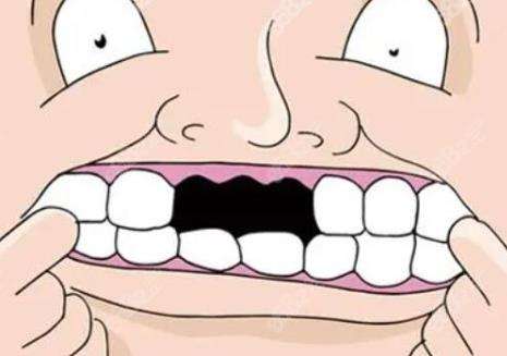 门牙补牙了会很明显吗