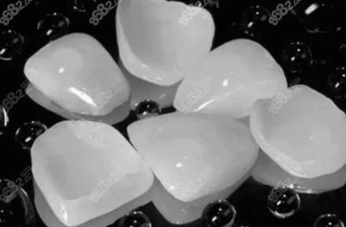 烤瓷贴面和铸瓷贴面的优缺点，如何选择适合自己的贴面类型？