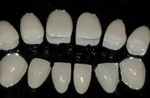 烤瓷贴面能维持多长的时间？如何延长烤瓷贴面的使用寿命？