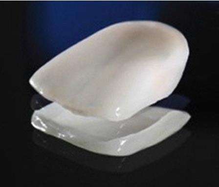 瓷贴面能保持多长时间？探究其持久性和耐用度！