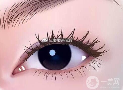 开眼角整形之后会有后遗症吗