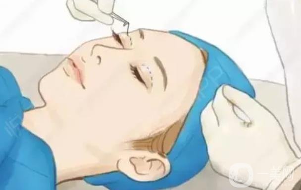 玻尿酸能去黑眼圈吗？玻尿酸去黑眼圈果怎么样？